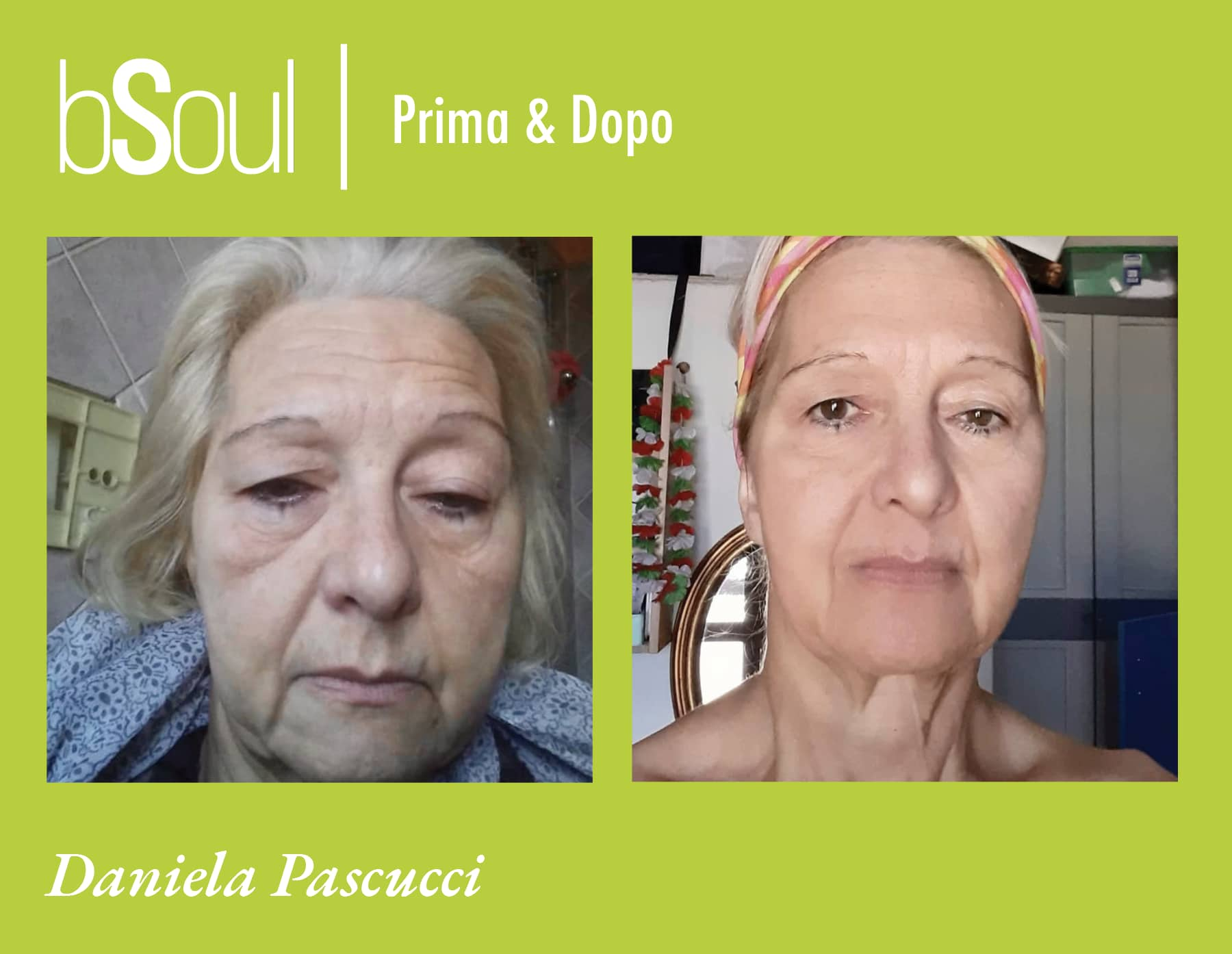 Prima e Dopo